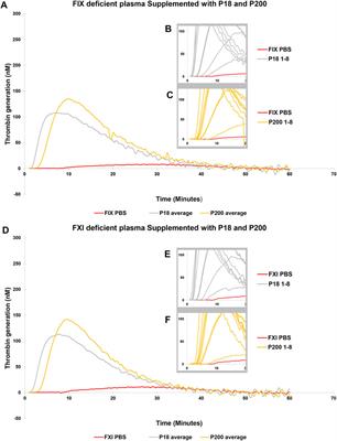 Urinary extracellular vesicles carry multiple activators and regulators of coagulation